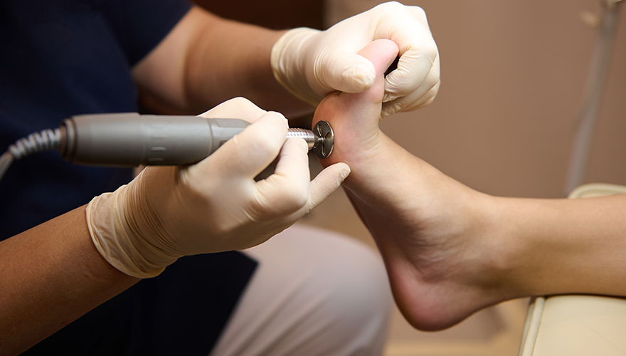 Quando Procurar um Profissional de Podologia?
